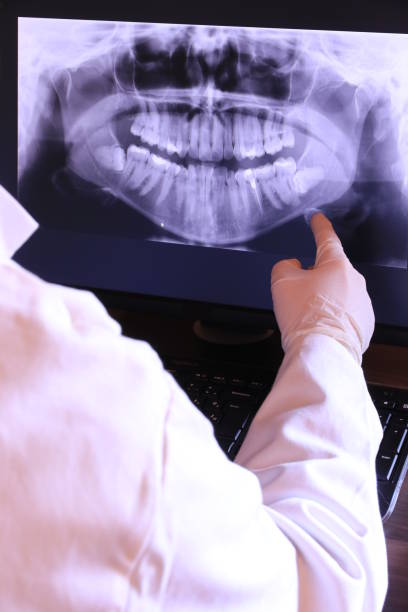 Best Emergency Gum Treatment in Pheasant Run, OH